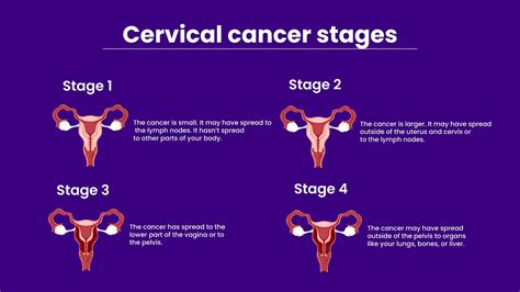 Cervical cancer